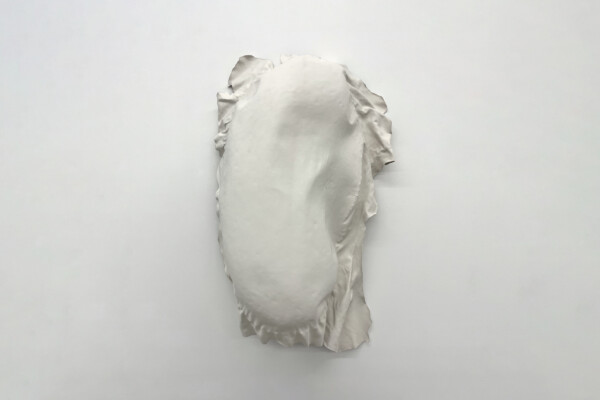 ED It could be MDD landscape SD