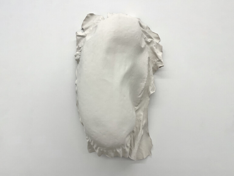 ED It could be MDD landscape SD